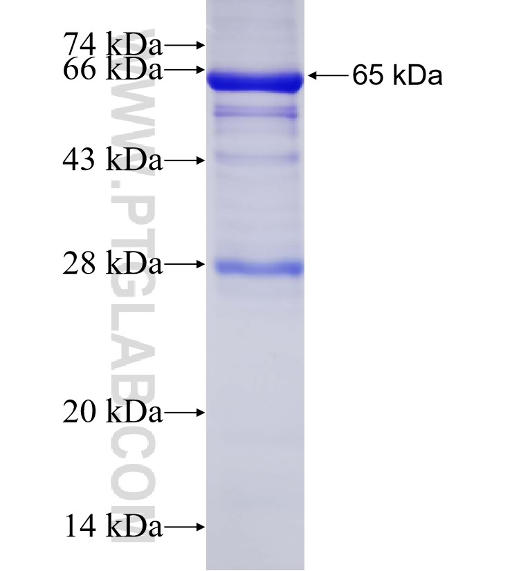 TBCC fusion protein Ag8719 SDS-PAGE