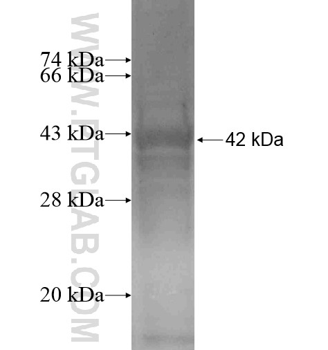 TBCCD1 fusion protein Ag16032 SDS-PAGE TBCCD1 fusion protein Ag16032 SDS-PAGE
