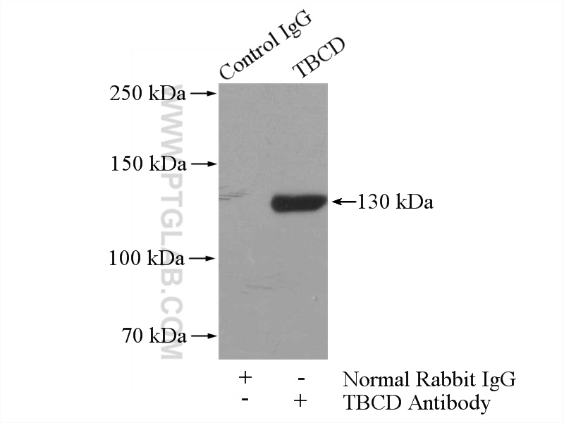 IP experiment of mouse brain using 14867-1-AP