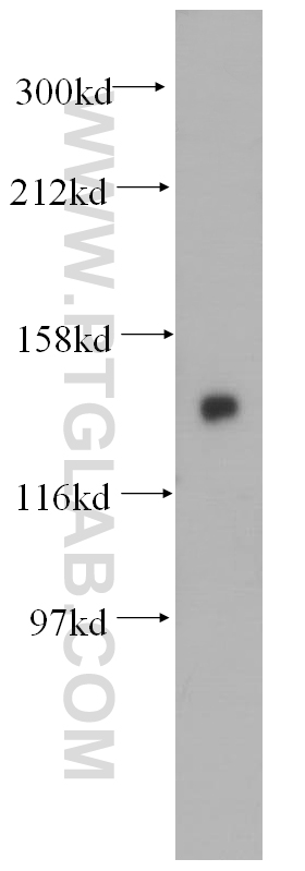 WB analysis of mouse brain using 14867-1-AP