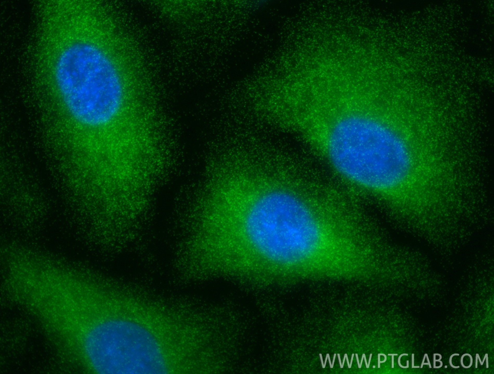 Immunofluorescent analysis of (-20°C Methanol) fixed A549 cells using TBCD antibody (82911-1-RR, Clone: 230209H7 ) at dilution of 1:400 and CoraLite®488-Conjugated Goat Anti-Rabbit IgG(H+L) (<a class='green' href='/productredirect?CatalogNo=SA00013-2' target='_blank'>SA00013-2</a>). IF Staining of A549 using 82911-1-RR