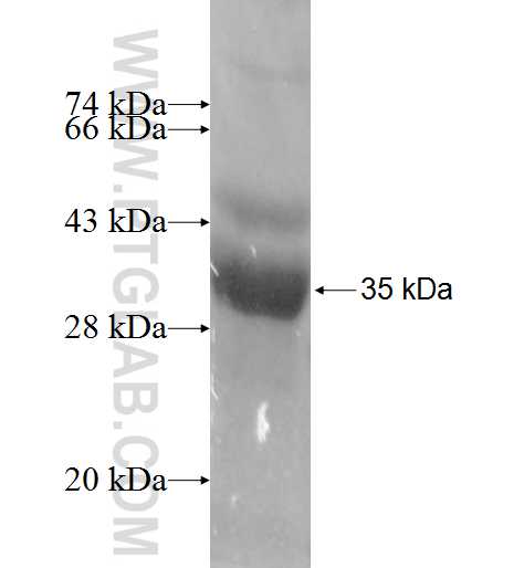TBCD fusion protein Ag8451 SDS-PAGE