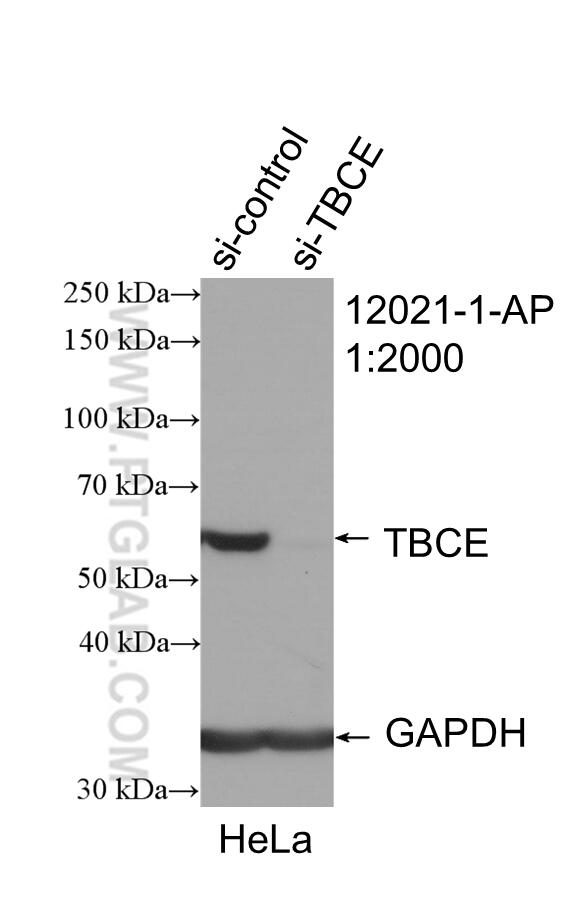 WB analysis of HeLa using 12021-1-AP