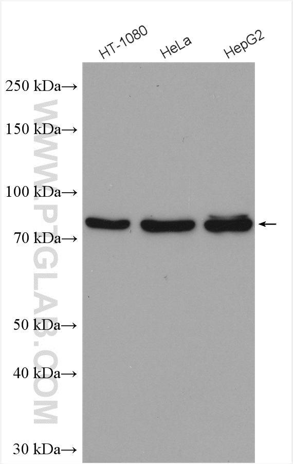 WB analysis using 28397-1-AP