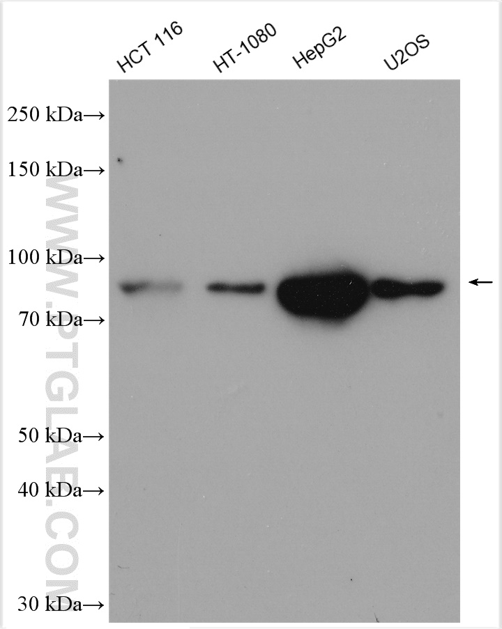 WB analysis using 28397-1-AP