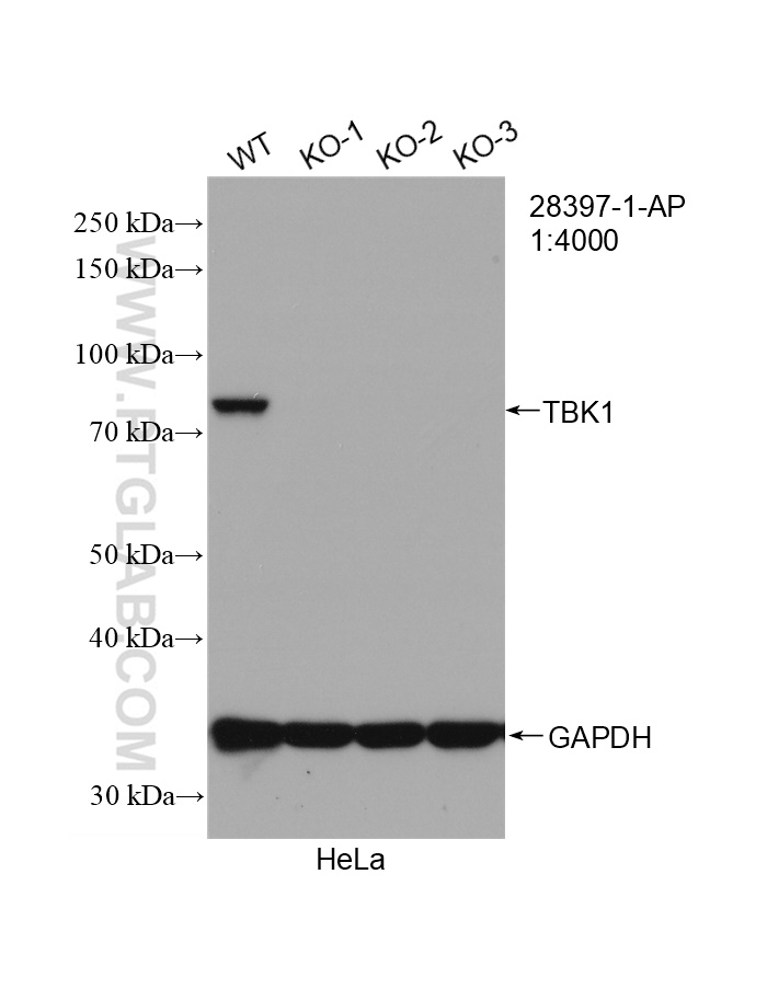 WB analysis of HeLa using 28397-1-AP