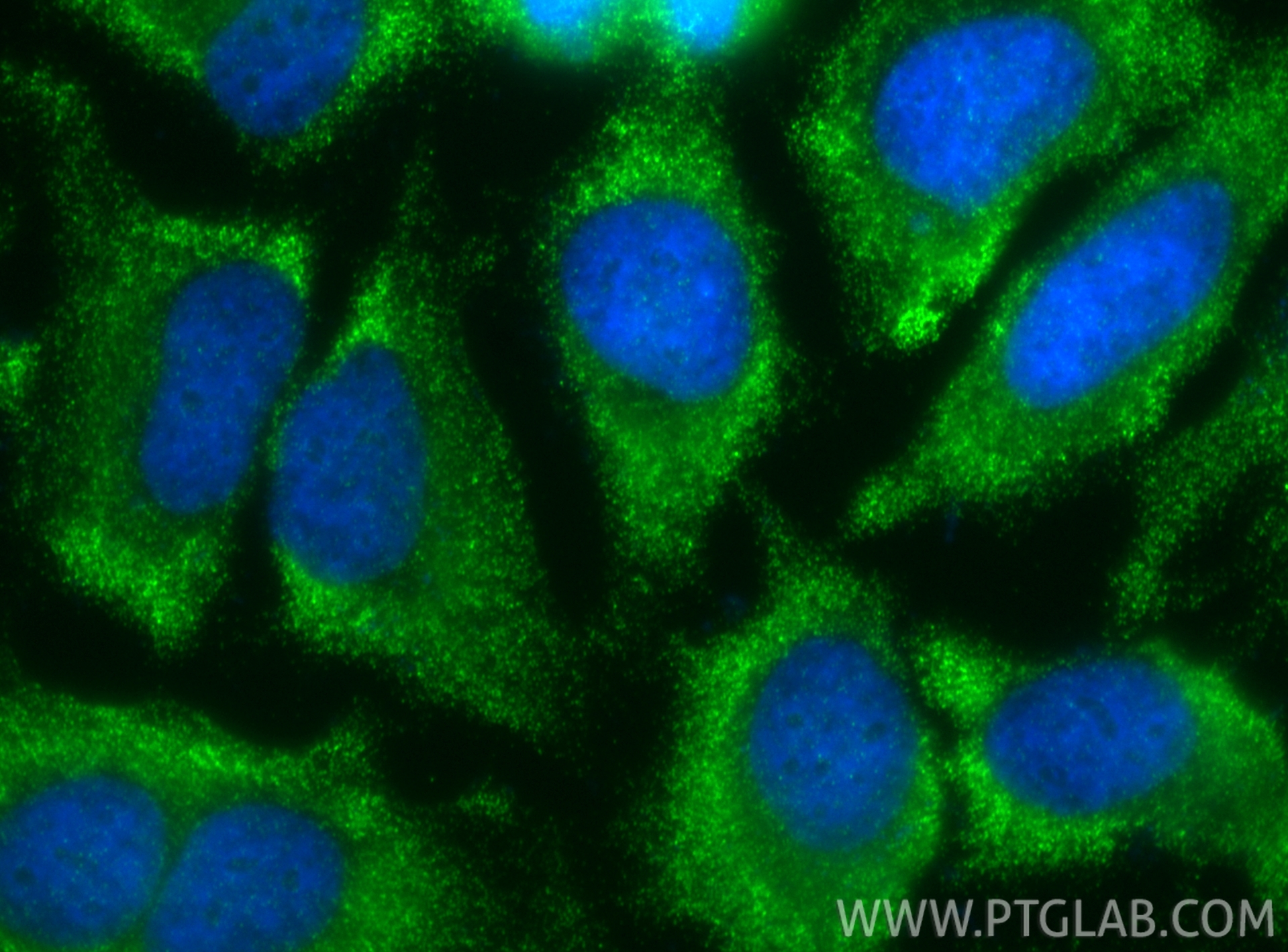 IF Staining of HeLa using 83686-3-RR