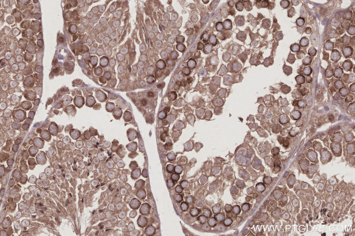 IHC staining of mouse testis using 83686-3-RR