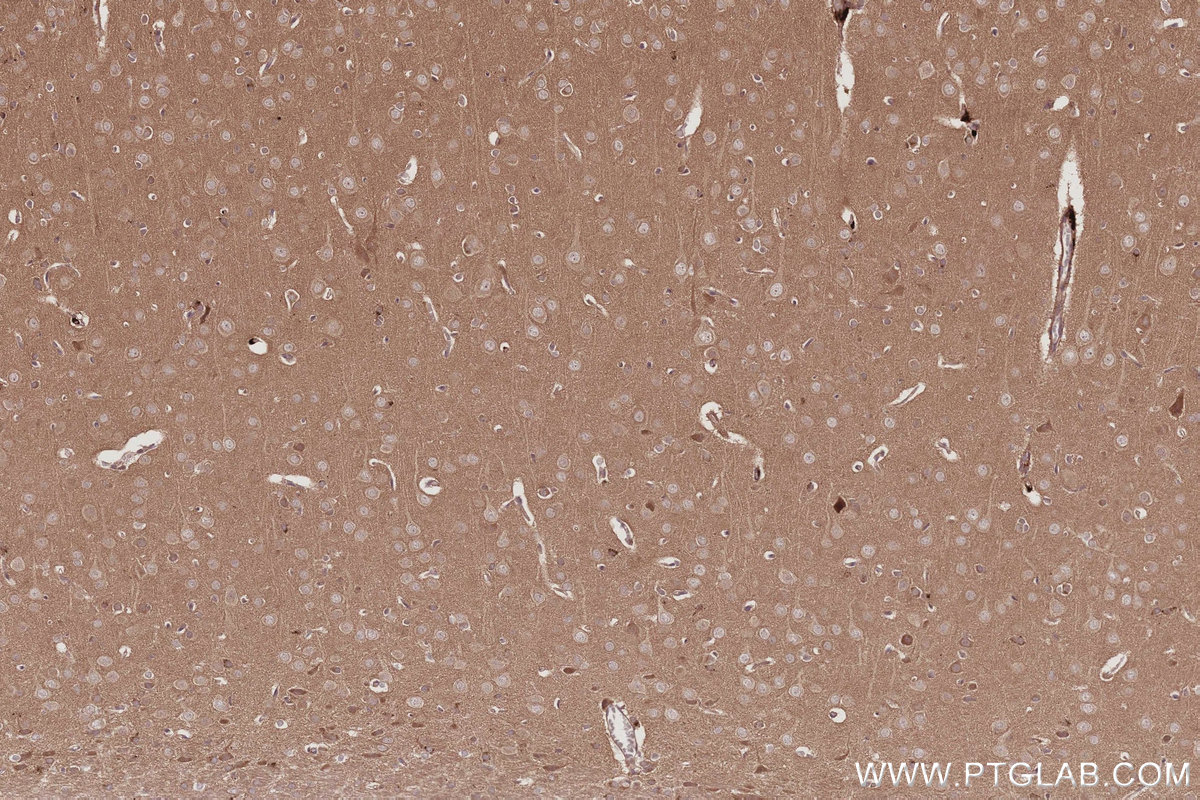 IHC staining of rat brain using 83686-3-RR