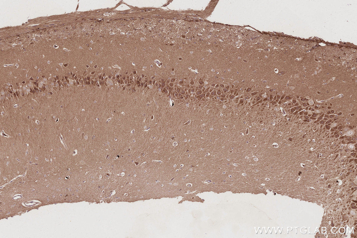 IHC staining of rat brain using 83686-3-RR