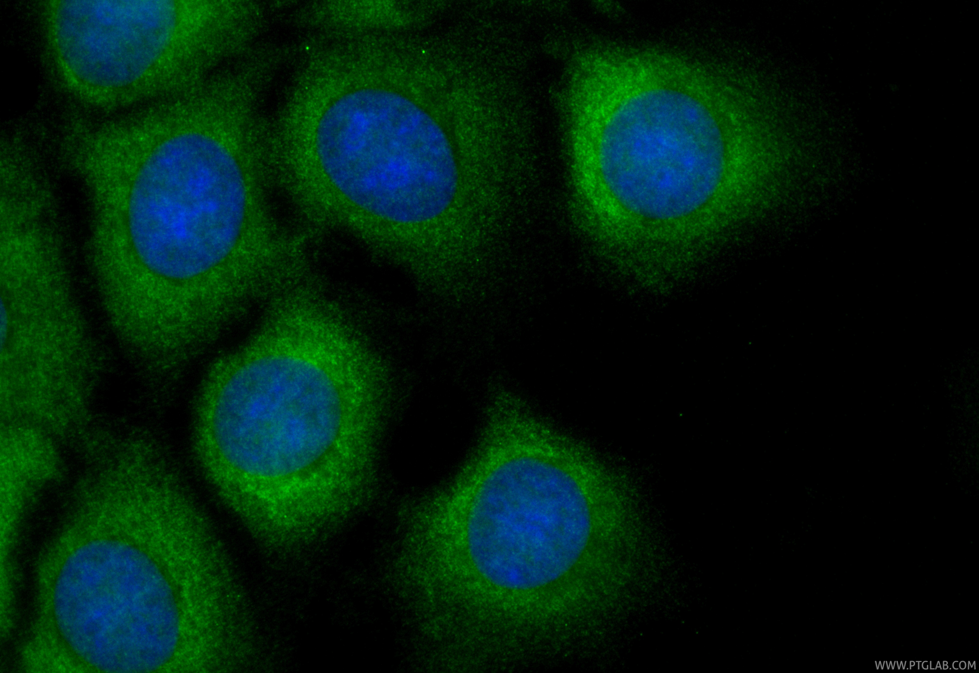 Immunofluorescent analysis of (-20°C Methanol) fixed MCF-7 cells using CoraLite® Plus 488 TBK1 antibody (CL488-83686-3, Clone: 240769G5 ) at dilution of 1:200. IF Staining of MCF-7 using CL488-83686-3