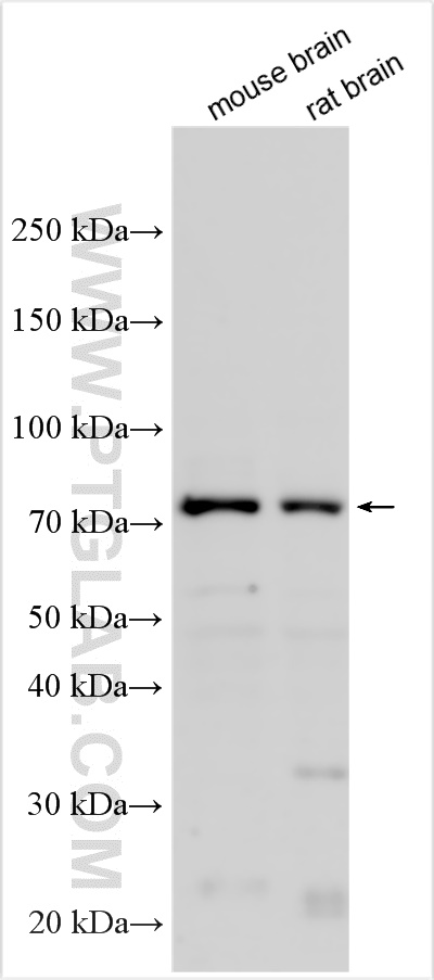 WB analysis using 32915-1-AP (same clone as 32915-1-PBS) WB analysis using 32915-1-AP (same clone as 32915-1-PBS)