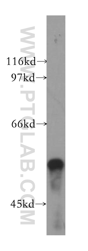 WB analysis of mouse pancreas using 13540-1-AP