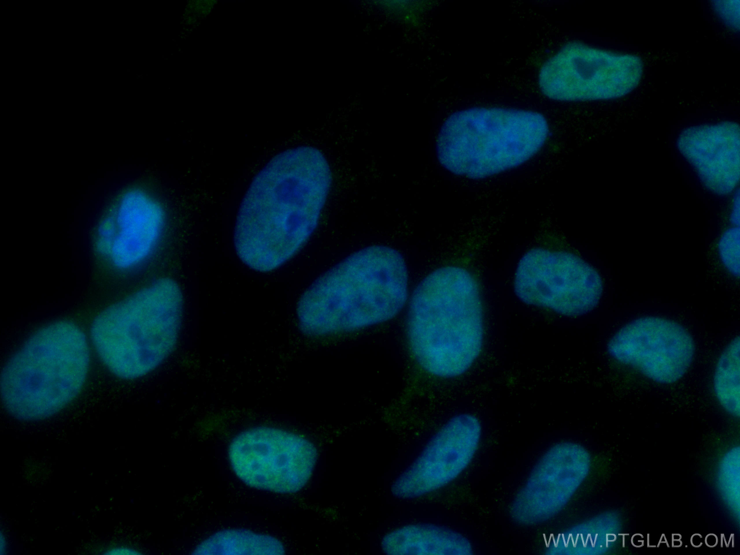 IF Staining of HEK-293 using 66955-1-Ig (same clone as 66955-1-PBS)