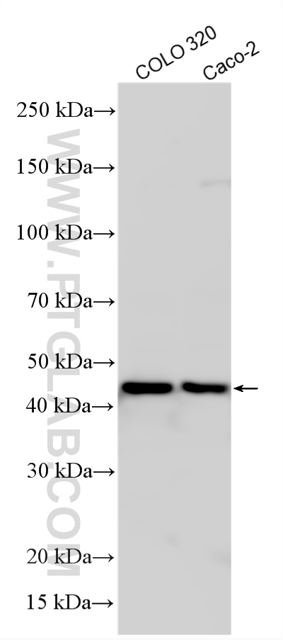 Various lysates were subjected to SDS PAGE followed by western blot with 12488-1-AP (TBL2 antibody) at dilution of 1:2000 incubated at room temperature for 1.5 hours. WB analysis using 12488-1-AP