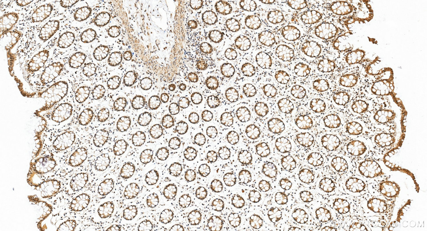 IHC staining of human colon using 22006-1-AP