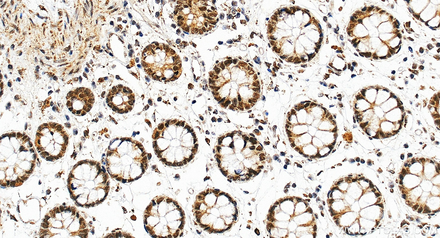 IHC staining of human colon using 22006-1-AP