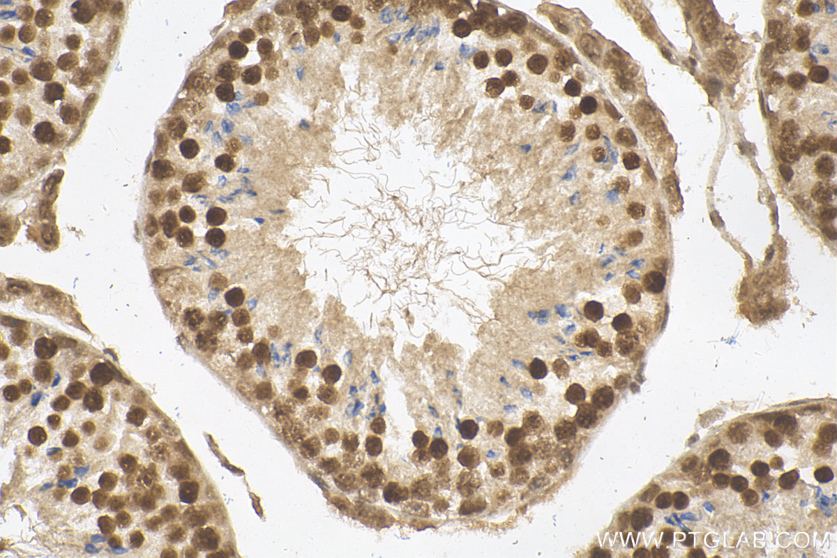 IHC staining of mouse testis using 22006-1-AP