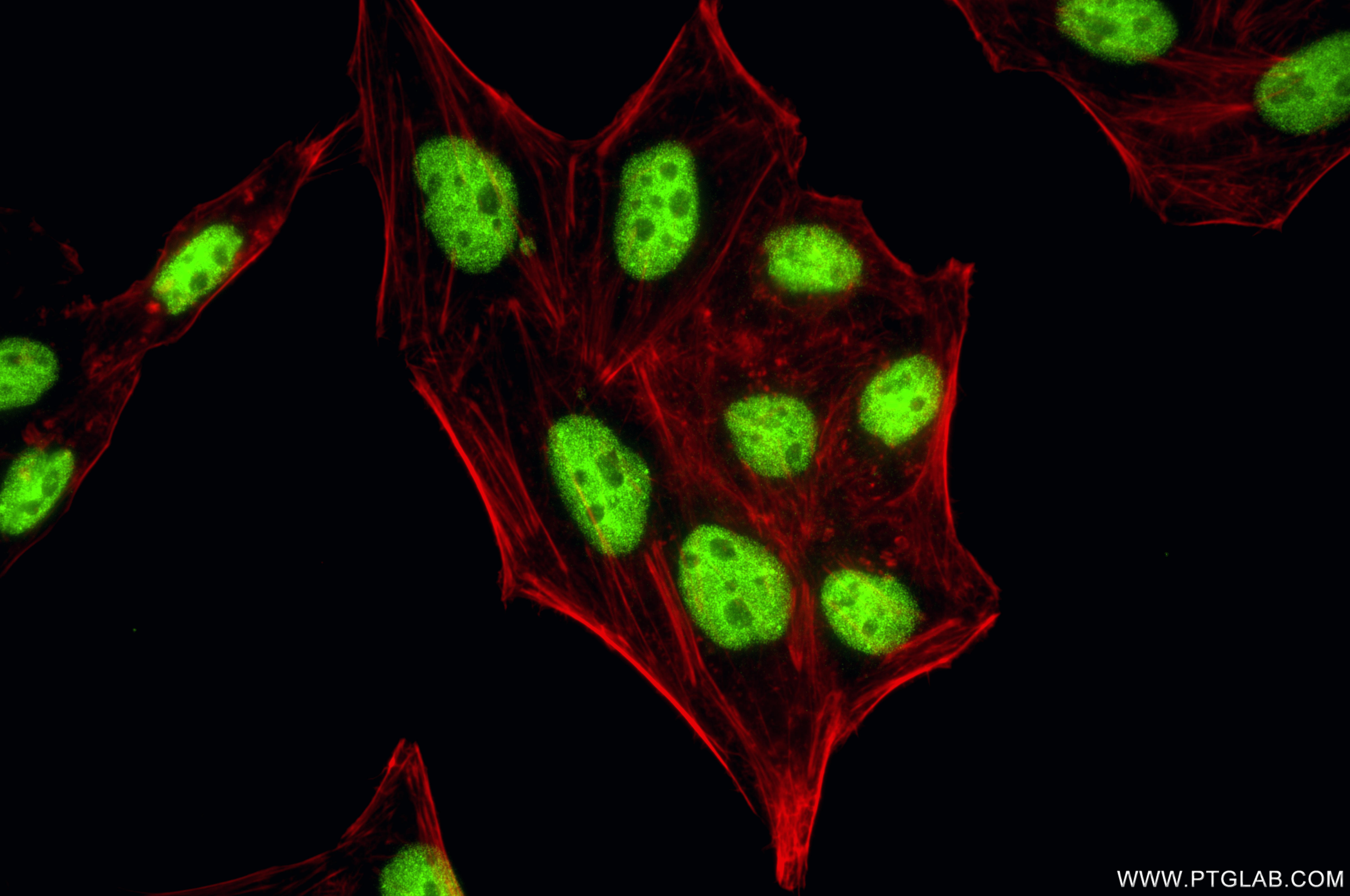 IF Staining of HepG2 using 87550-1-RR (same clone as 87550-1-PBS)