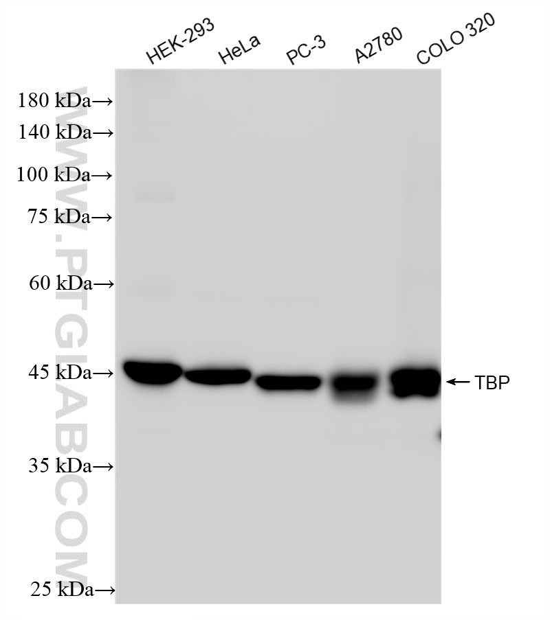 WB analysis using 87550-1-RR (same clone as 87550-1-PBS)