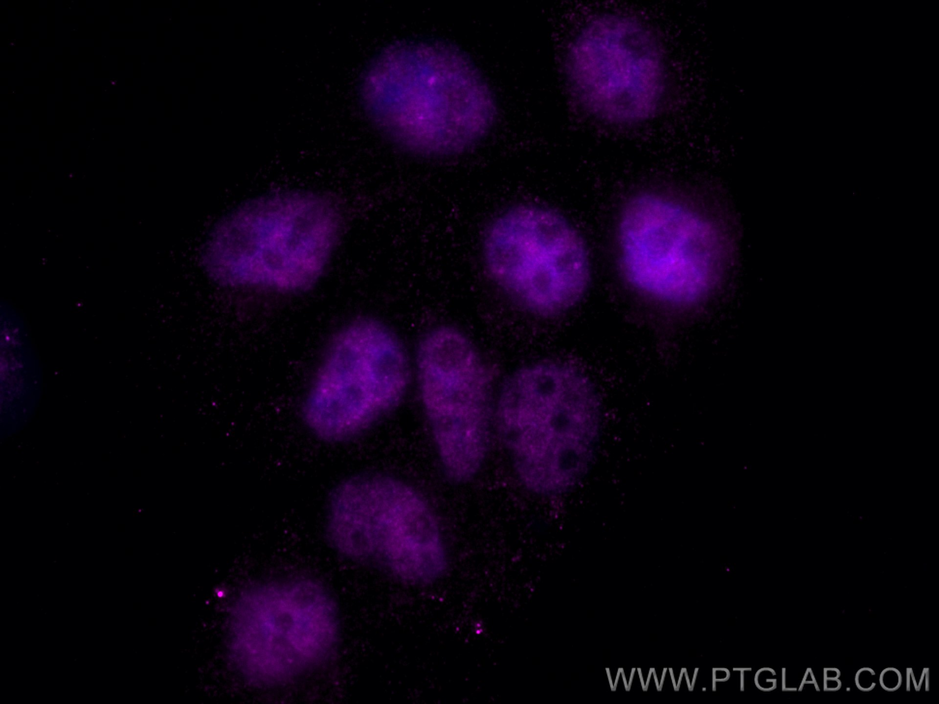 IF Staining of A431 using CL647-66166