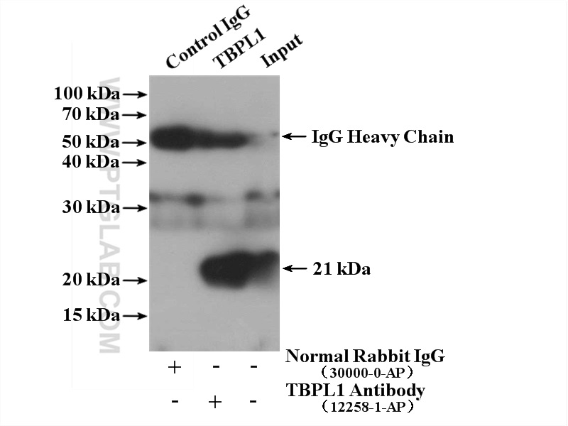 IP experiment of mouse testis using 12258-1-AP