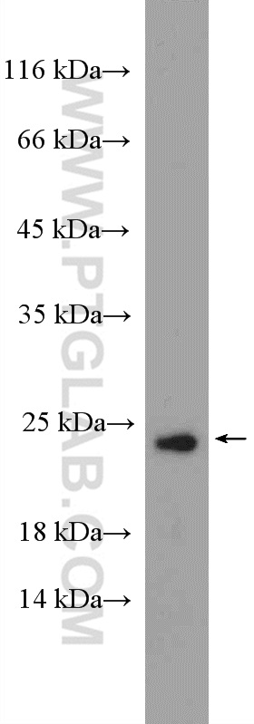 WB analysis of mouse testis using 12258-1-AP