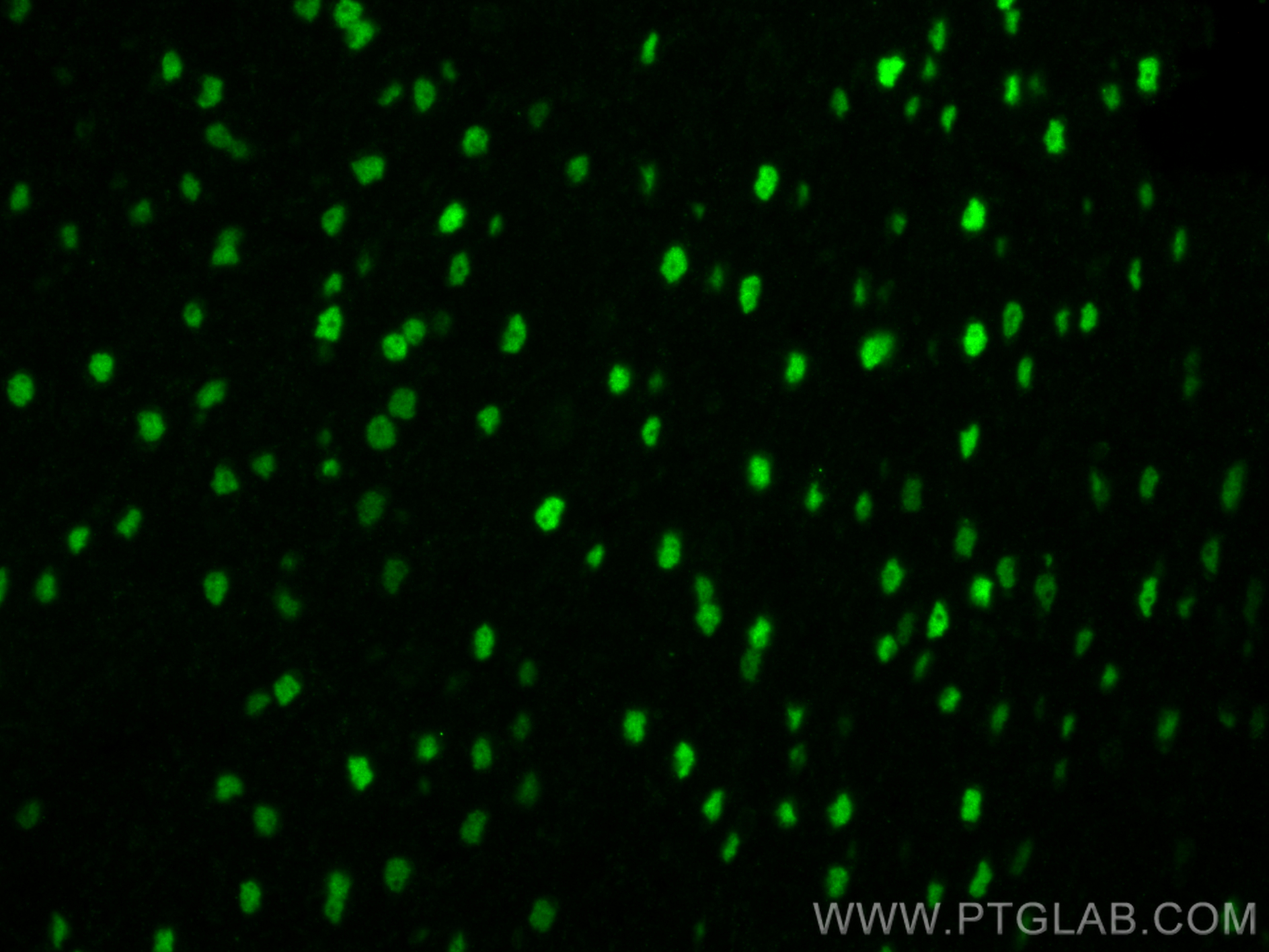 IF Staining of mouse brain using 66564-1-Ig (same clone as 66564-1-PBS)