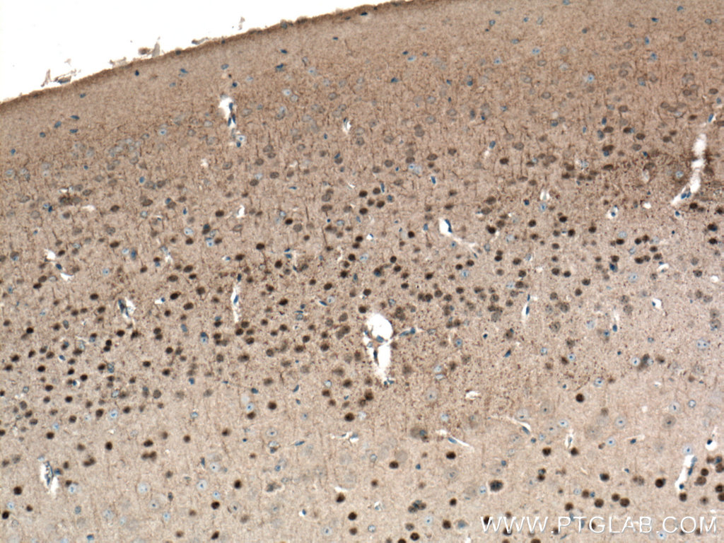 IHC staining of mouse brain using 66564-1-Ig (same clone as 66564-1-PBS)
