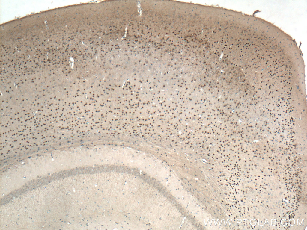 IHC staining of mouse brain using 66564-1-Ig (same clone as 66564-1-PBS)