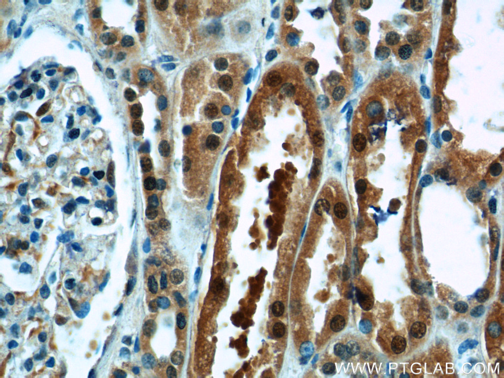 IHC staining of human kidney using 23237-1-AP