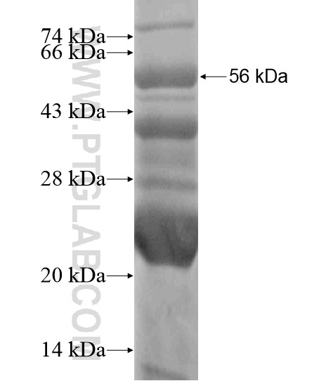 TBX18 fusion protein Ag19212 SDS-PAGE TBX18 fusion protein Ag19212 SDS-PAGE