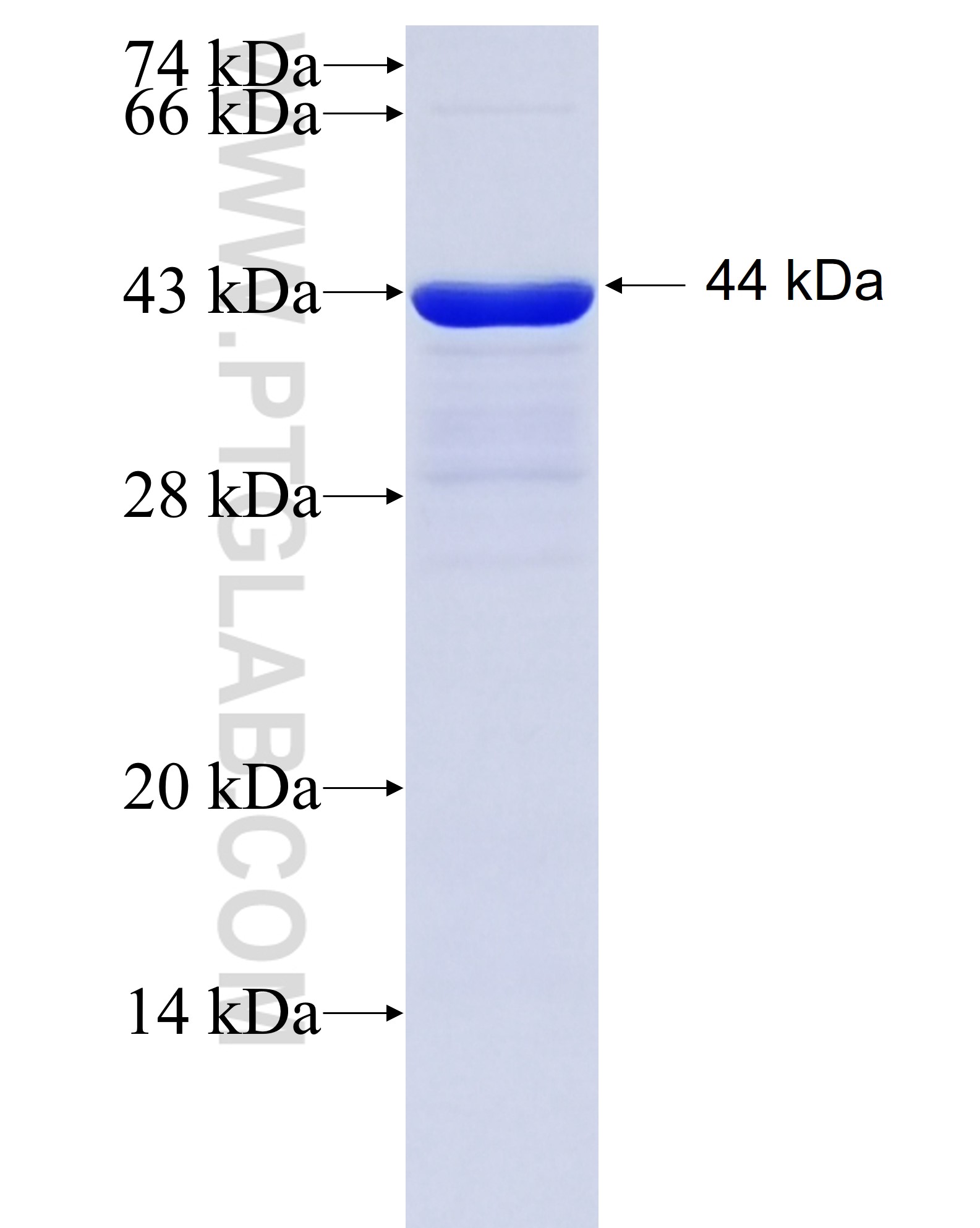 TBX19 fusion protein Ag12781 SDS-PAGE TBX19 fusion protein Ag12781 SDS-PAGE