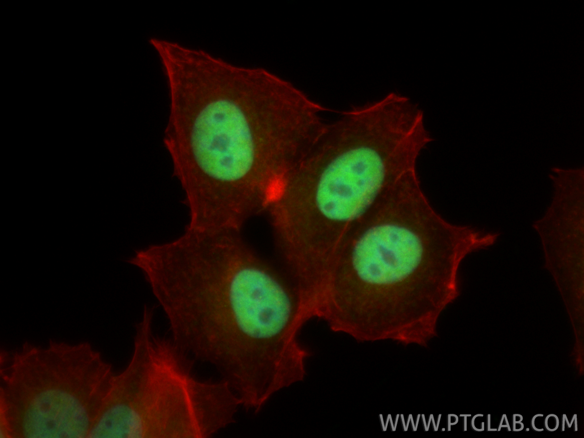 IF Staining of MCF-7 using 16930-1-AP
