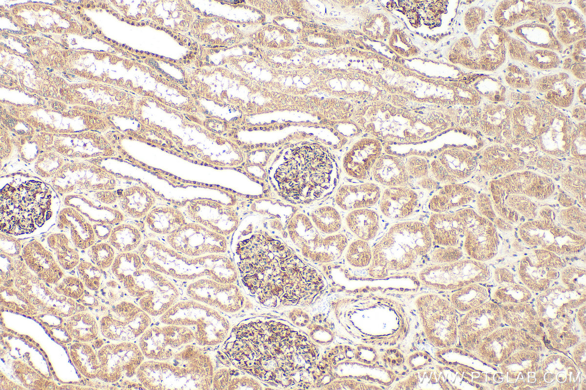 IHC staining of human kidney using 16930-1-AP