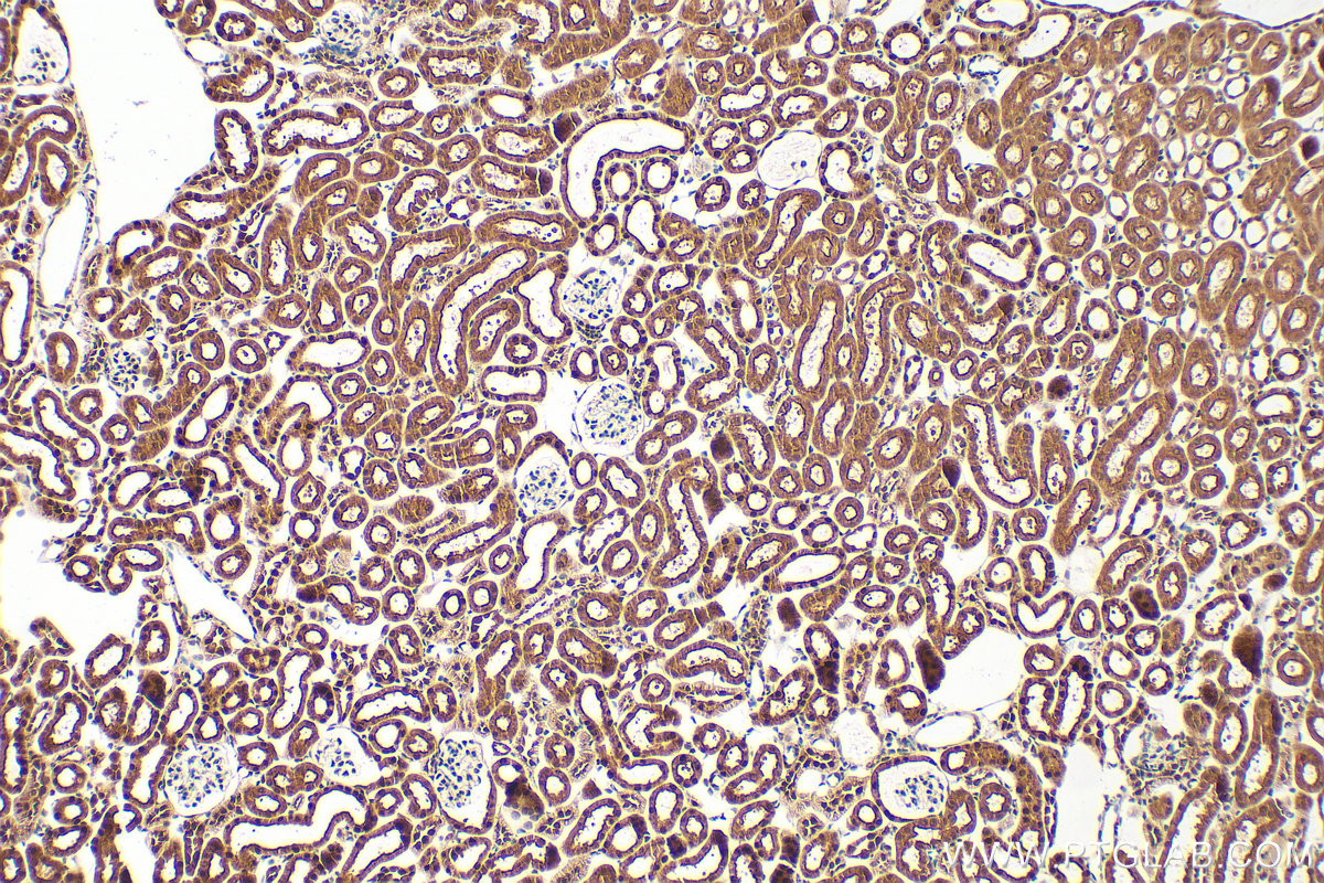 IHC staining of mouse kidney using 16930-1-AP