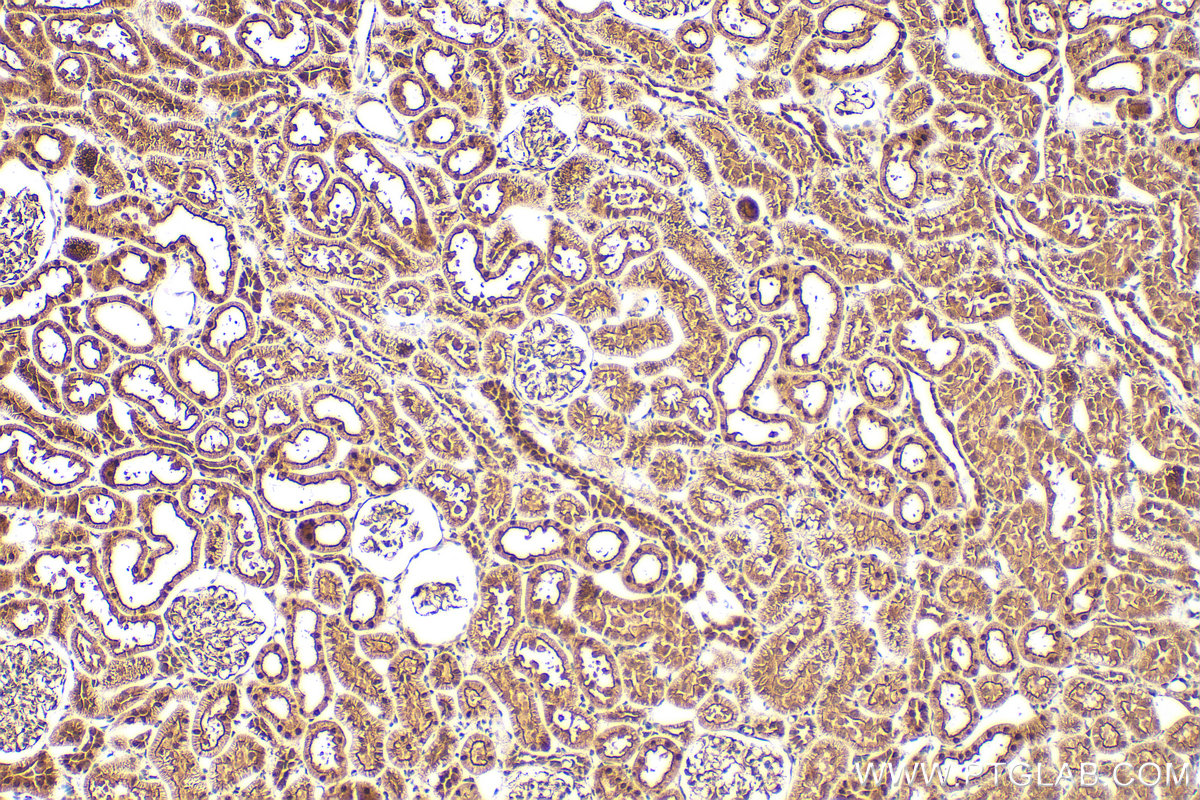 IHC staining of rat kidney using 16930-1-AP
