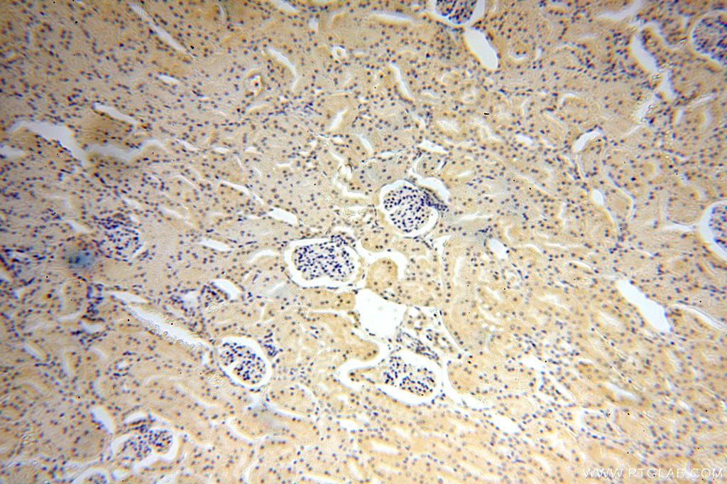 IHC staining of human kidney using 16930-1-AP