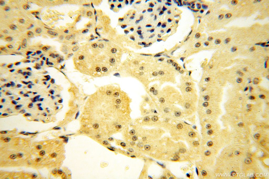 IHC staining of human kidney using 16930-1-AP