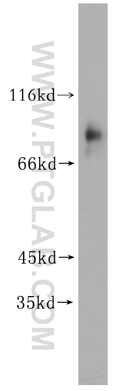 WB analysis of human placenta using 16930-1-AP