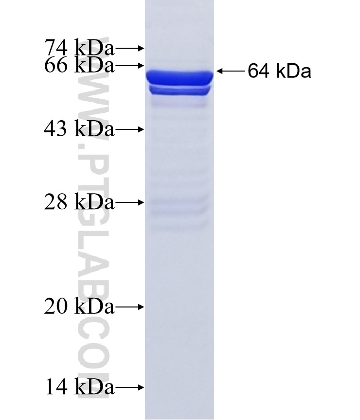 TBX2 fusion protein Ag10373 SDS-PAGE TBX2 fusion protein Ag10373 SDS-PAGE