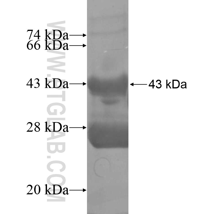 TBX2 fusion protein Ag11262 SDS-PAGE TBX2 fusion protein Ag11262 SDS-PAGE
