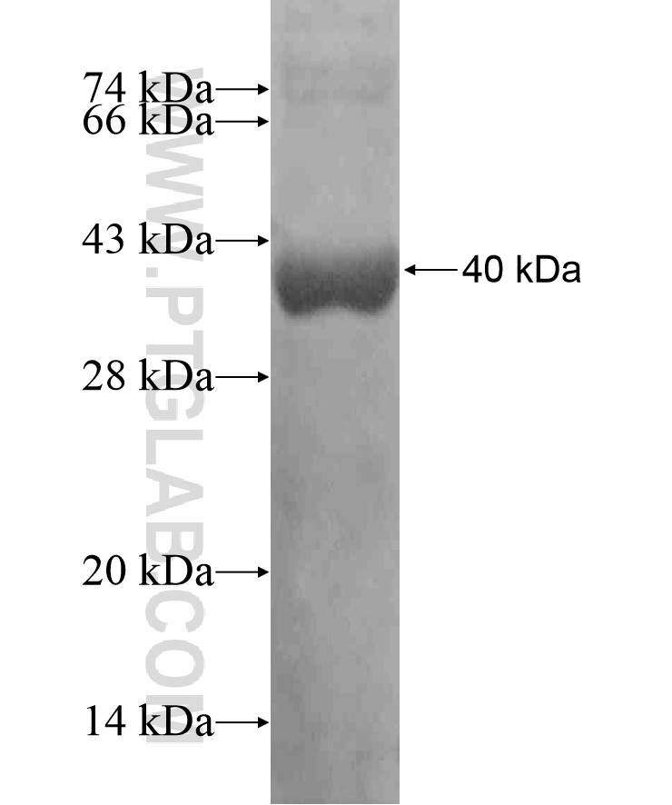 TBX2 fusion protein Ag17860 SDS-PAGE