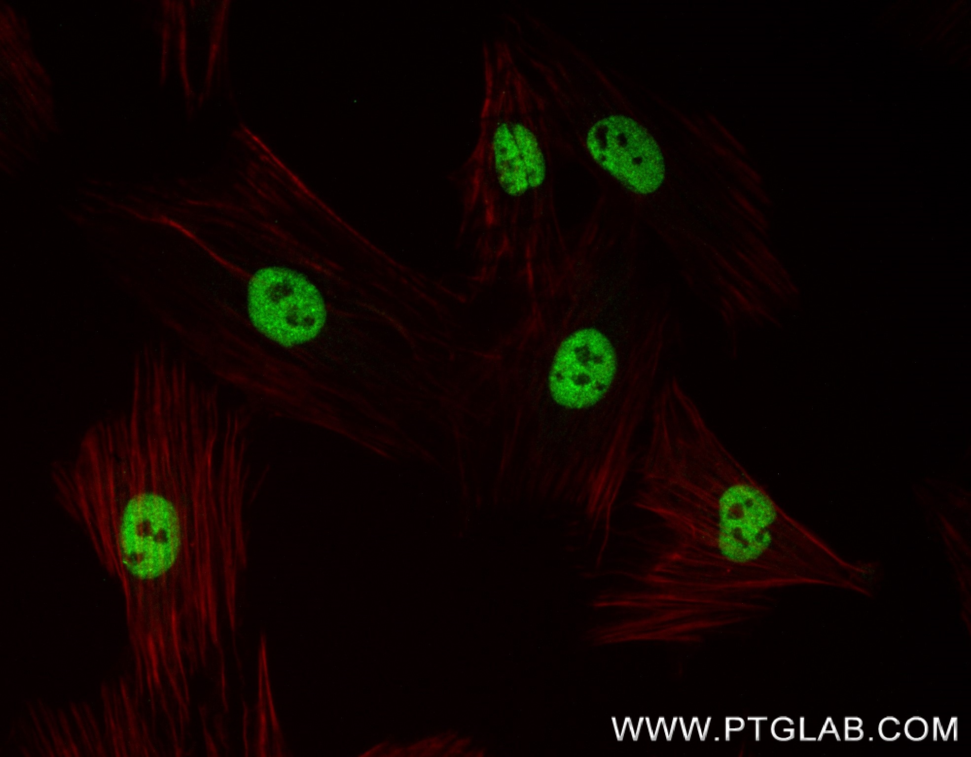 IF Staining of H9C2 using 83414-3-RR (same clone as 83414-3-PBS)