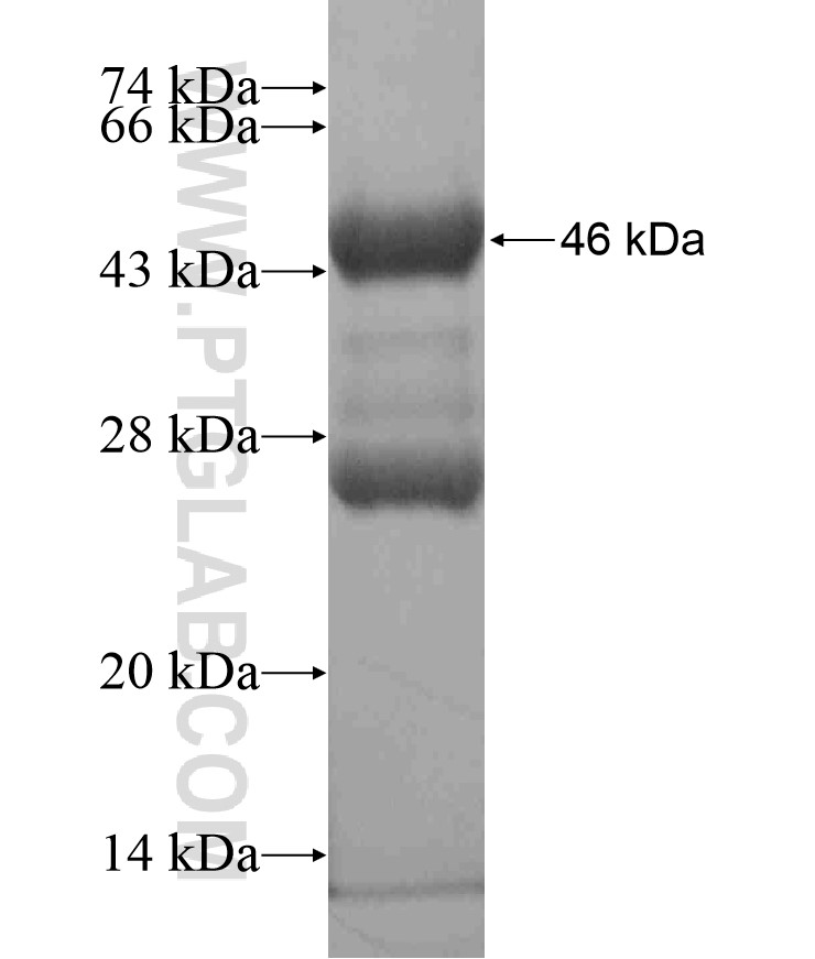 TBX20 fusion protein Ag18495 SDS-PAGE TBX20 fusion protein Ag18495 SDS-PAGE