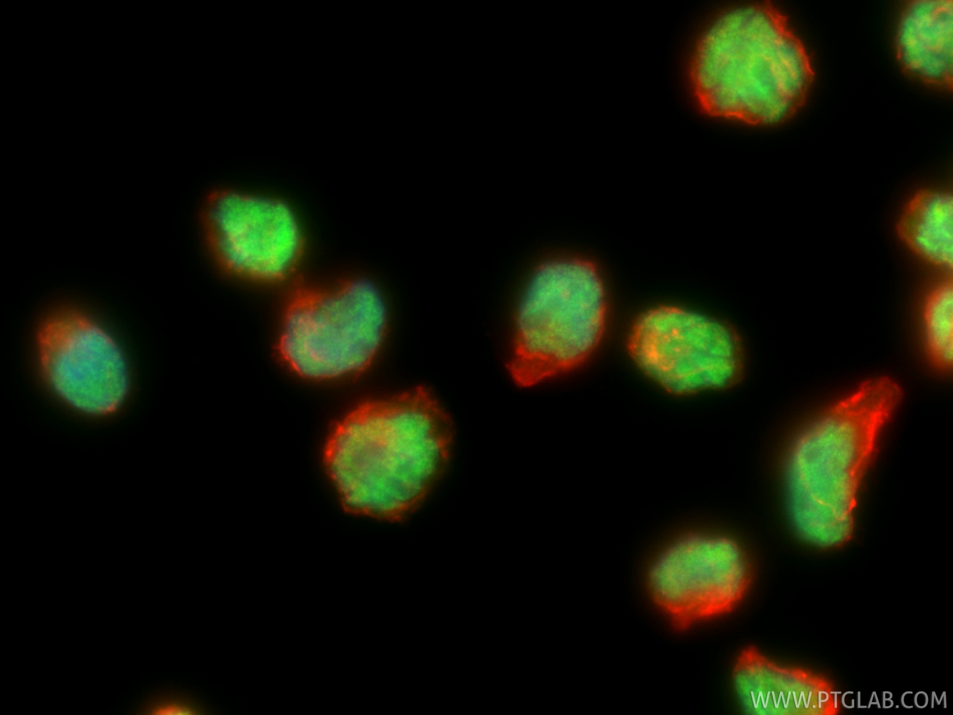 IF Staining of NK-92 using 83804-10-RR (same clone as 83804-10-PBS) IF Staining of NK-92 using 83804-10-RR (same clone as 83804-10-PBS)