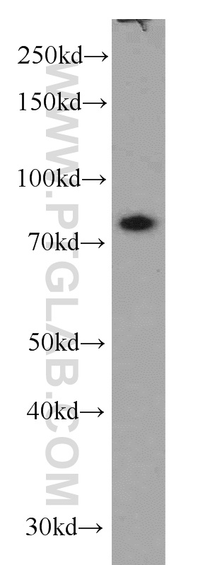 WB analysis of HepG2 using 16741-1-AP