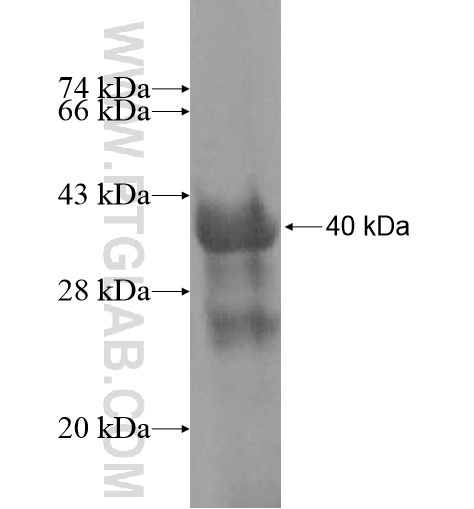 TBX3 fusion protein Ag10195 SDS-PAGE TBX3 fusion protein Ag10195 SDS-PAGE
