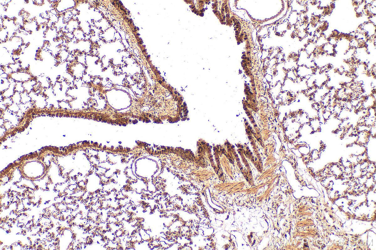 IHC staining of rat lung using 13178-1-AP