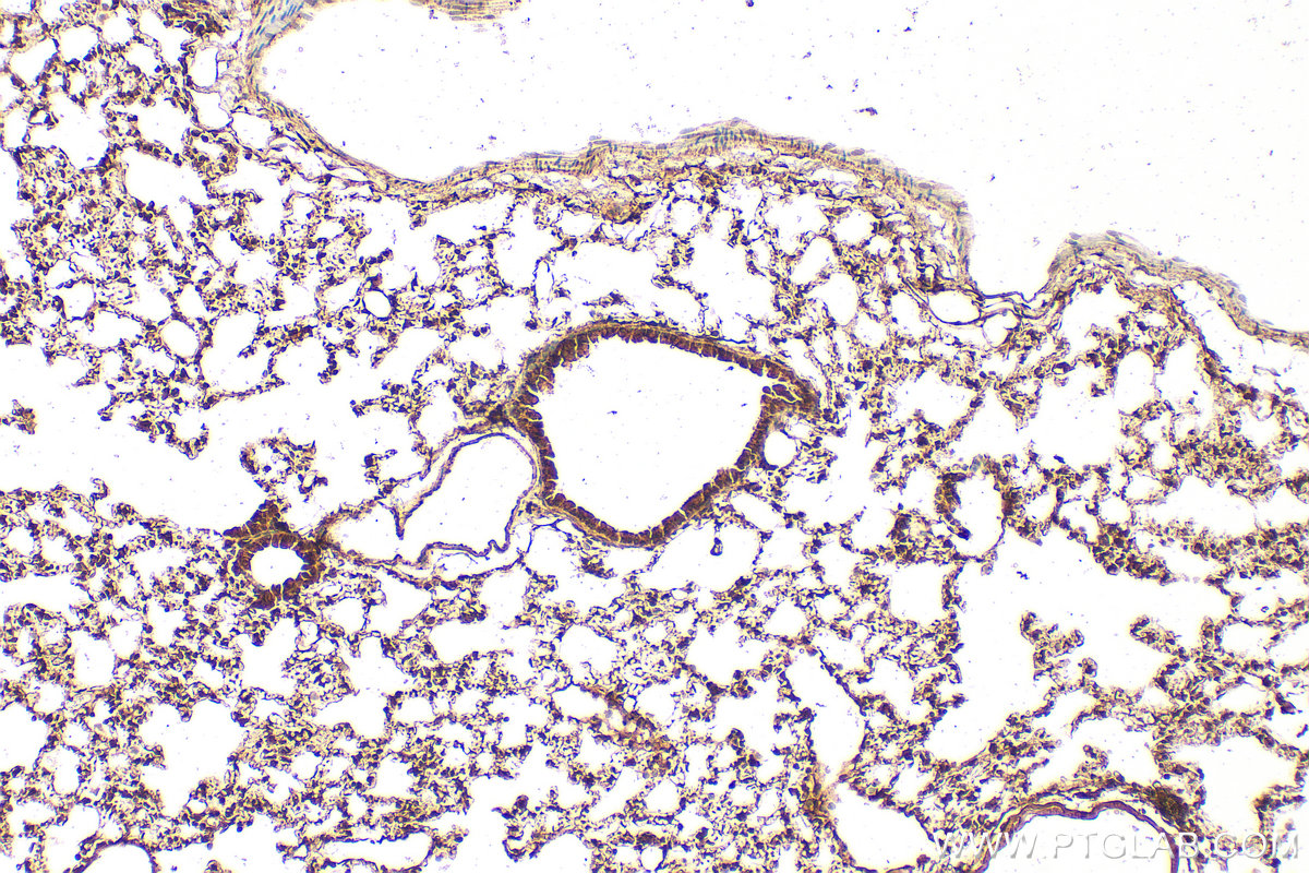 IHC staining of mouse lung using 13178-1-AP